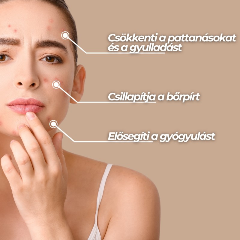 Problémás bőrápolás készlet