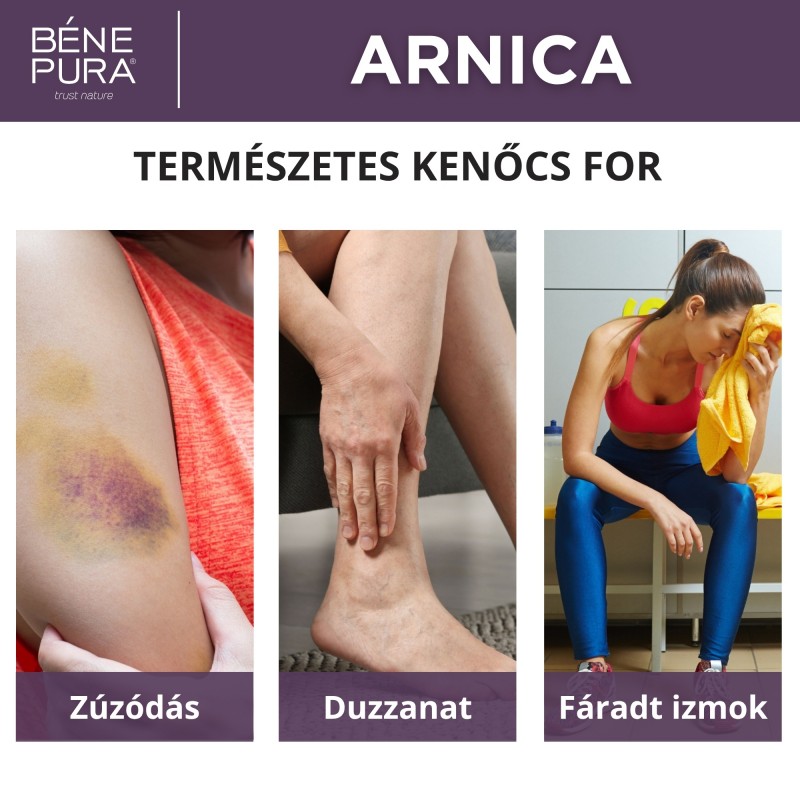 3x Zúzódás Kenőcs Árnikával - 40ml
