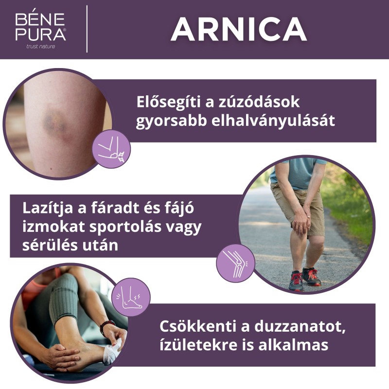 3x Zúzódás Kenőcs Árnikával - 40ml