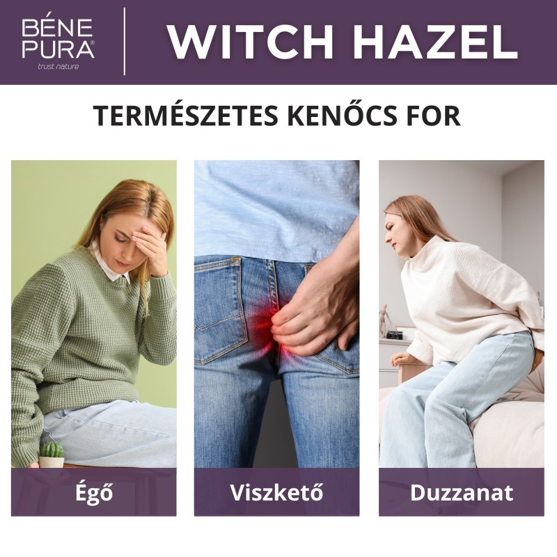 Aranyér Kenőcs Varázsmogyoróval - 40ml