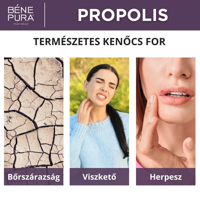 Viszketés elleni Kenőcs 30% Propolisszal - 40ml