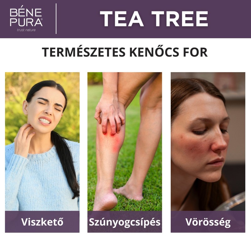 Viszketés elleni Kenőcs Teafával - 40ml