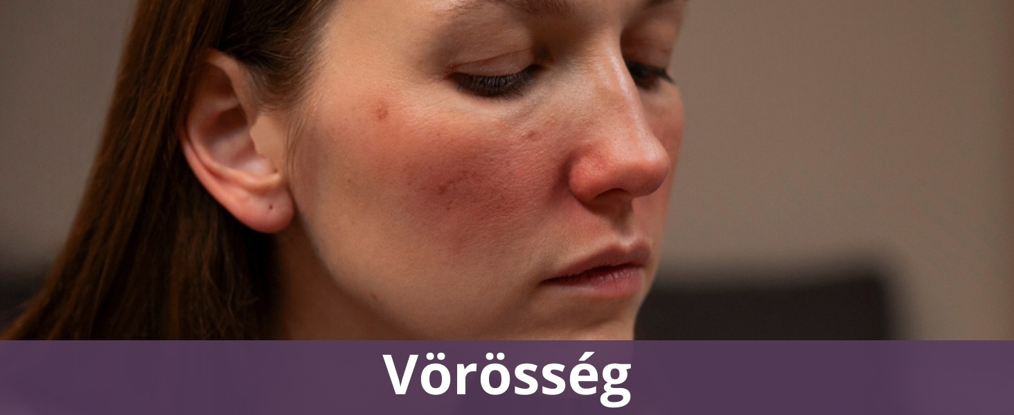 Vörösség