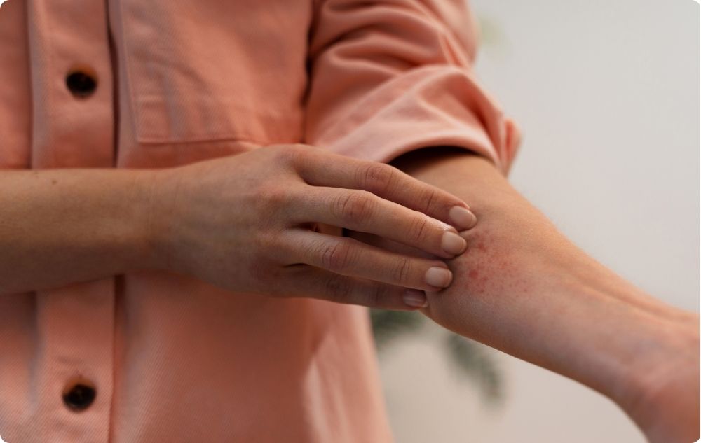 Ekcéma és dermatitis kezelése